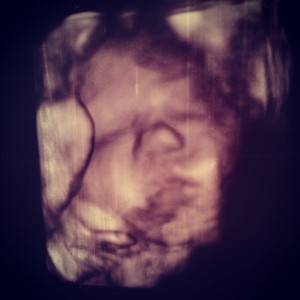 Senaste ultraljudsbilden på vår bebis. Kanske till hjälp för den som vågar gissa kön och födelsedag.